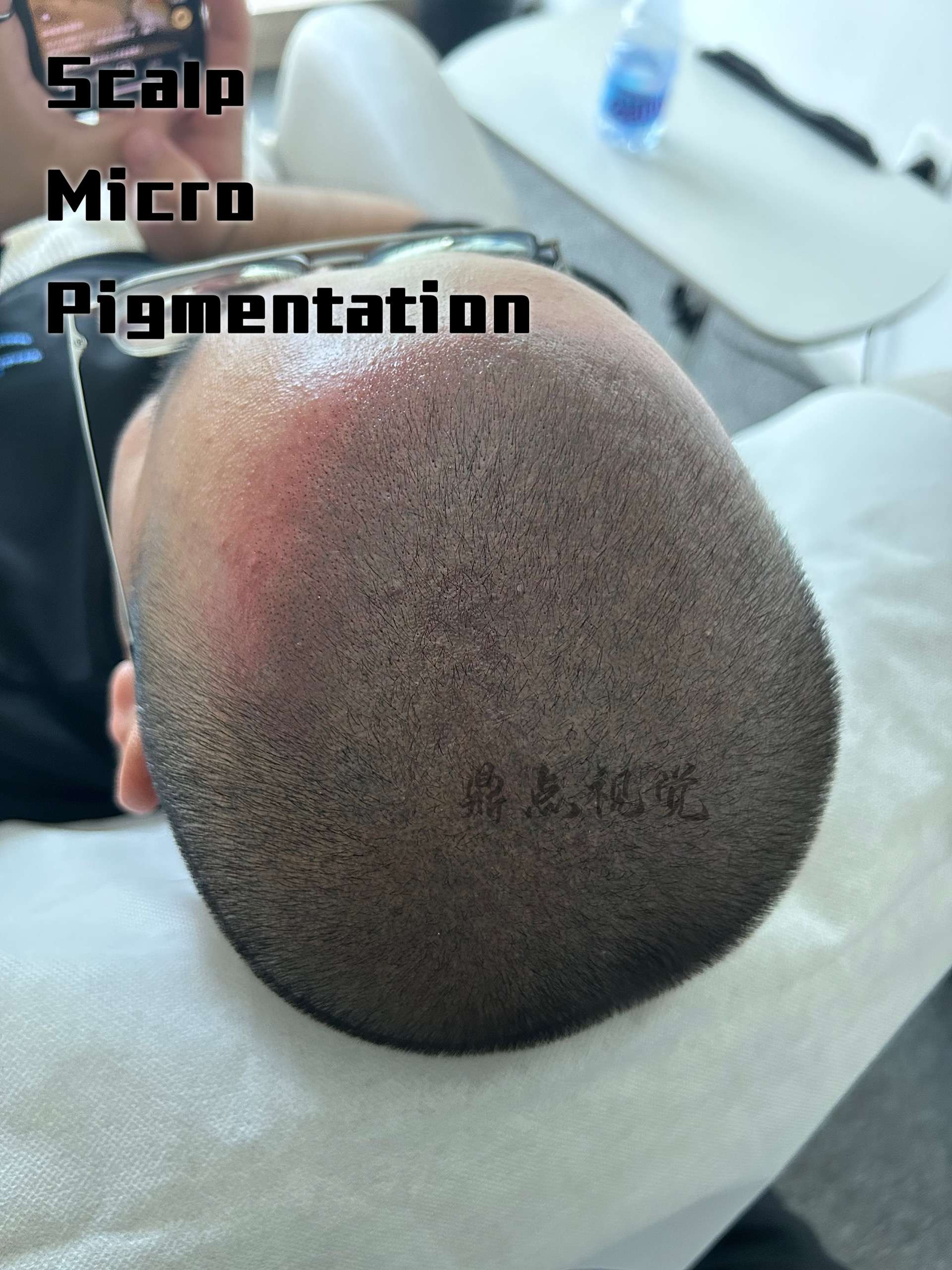 纹发效果#脱发鼎点(北京)美容美发中心 经营者67纹发师江涛登录