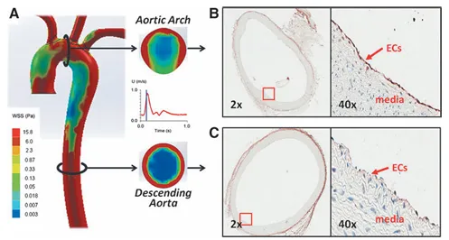 紊亂血流誘導(dǎo)自噬并損傷自噬流以擾亂線粒體穩(wěn)態(tài)