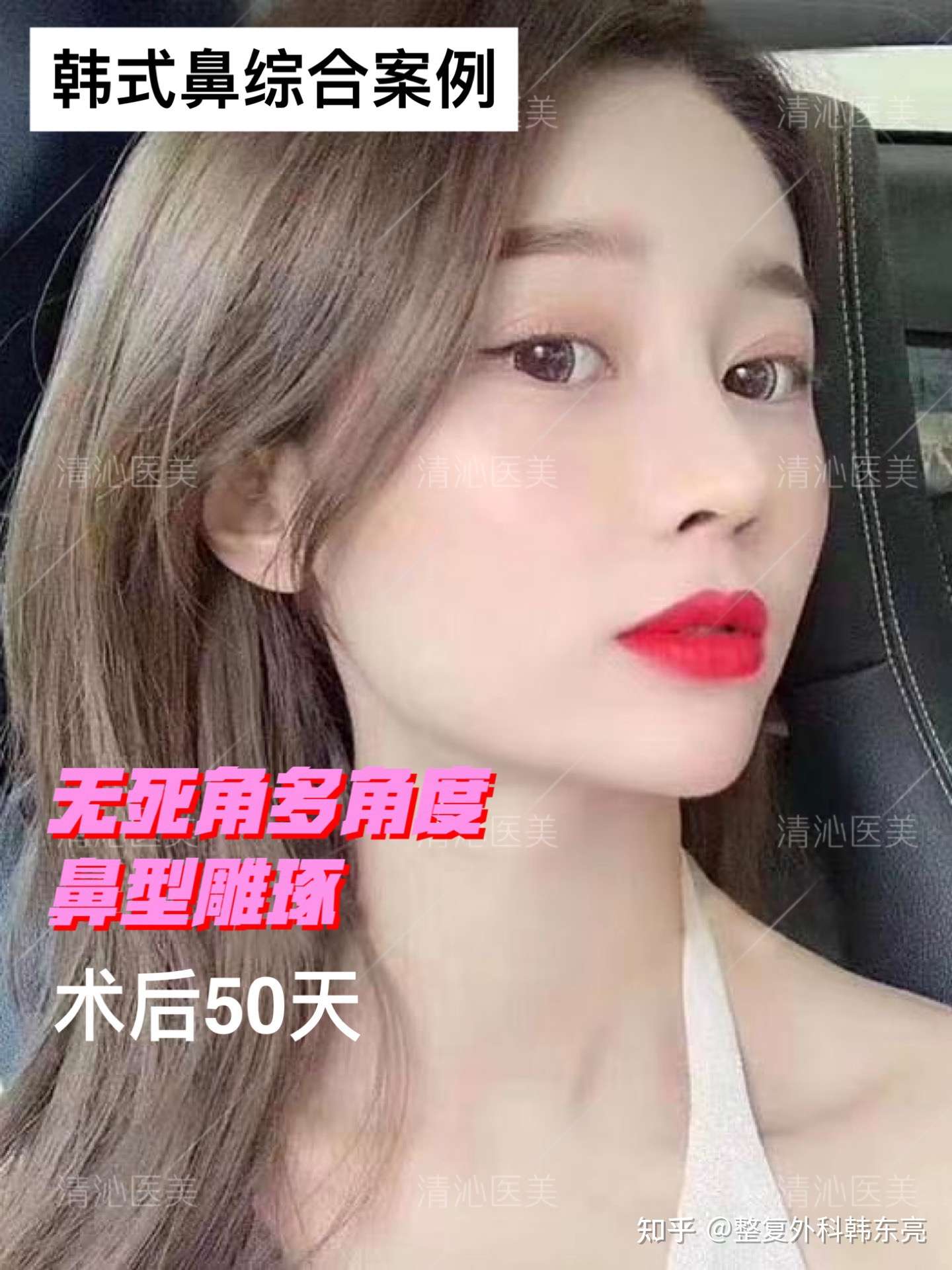 韩式隆鼻立体混血美感原相机拍照每个角度都好看