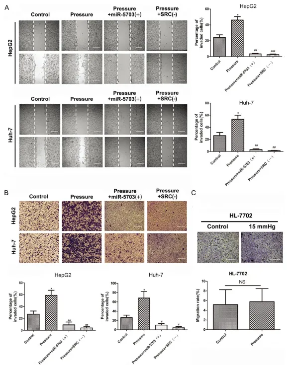 壓力響應(yīng)型 miRNA - 5703 的過(guò)表達(dá)抑制壓力誘導(dǎo)的肝癌生長(zhǎng)和轉(zhuǎn)移