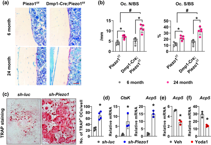 Piezo1 對抗與衰老相關的皮質骨丟失