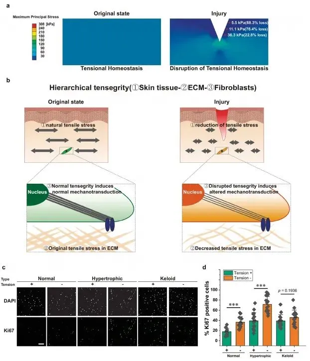 成纖維細(xì)胞中張力敏感的 HOX 基因表達(dá)用于差異瘢痕形成