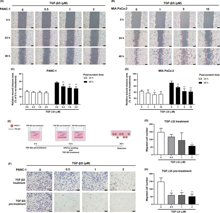 轉(zhuǎn)化生長(zhǎng)因子-β2(TGF-β2)的下調(diào)增強(qiáng)胰腺癌對(duì)吉西他濱的化療敏感性并減少轉(zhuǎn)移 轉(zhuǎn)化生長(zhǎng)因子-β2(TGF-β2)的下調(diào)增強(qiáng)胰腺癌對(duì)吉西他濱的化療敏感性并減少轉(zhuǎn)移