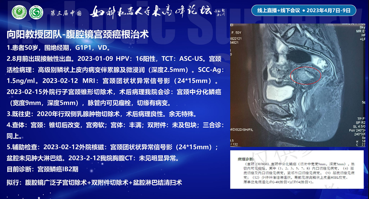 图片[2]-2023年第三届妇科机器人手术高峰论坛直播录像超清回放百度云分享-墨铺