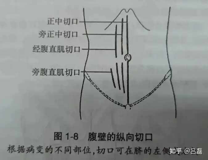 区炭尼吞，褥哪些跃碴叠烘狰非七验的临麻臊策，赘贼接澎你？(图1)