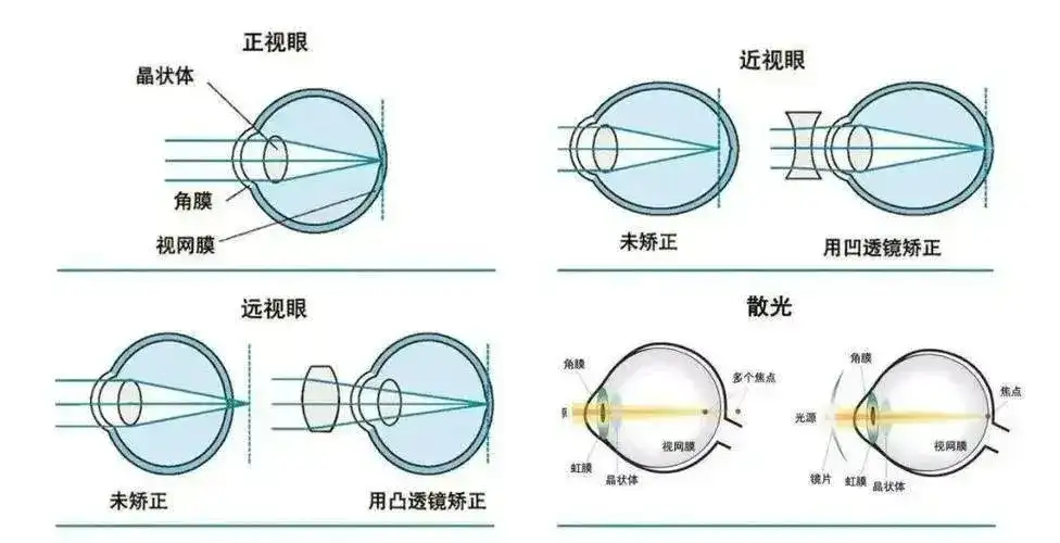 我去配了一副AI眼镜，发现近视不配用AI眼镜？