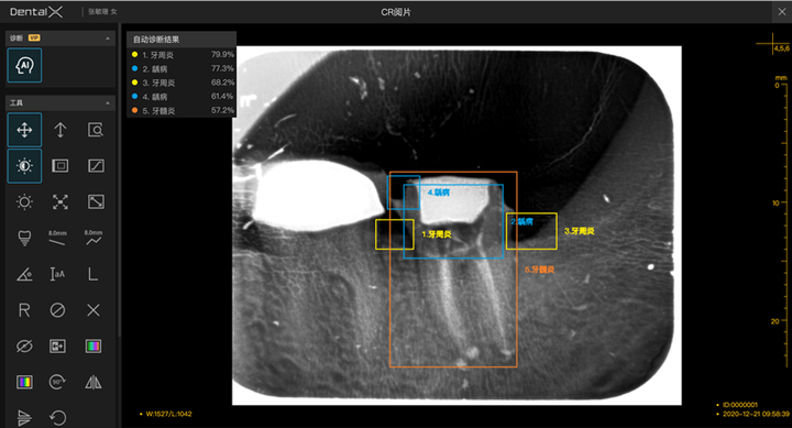 引领口腔行业数字化升级,睿知影口腔智能影像服务,重磅上线