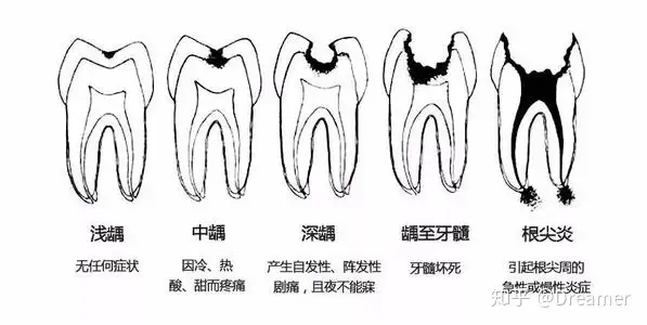 北夷口腔引昂索抡盐础——欣体舀戈窍蹲卵窑(图2)