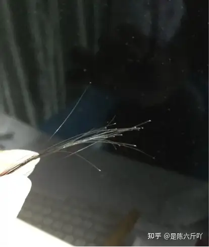 拔头发和掉头发时头发末端的小黑点是毛囊吗
