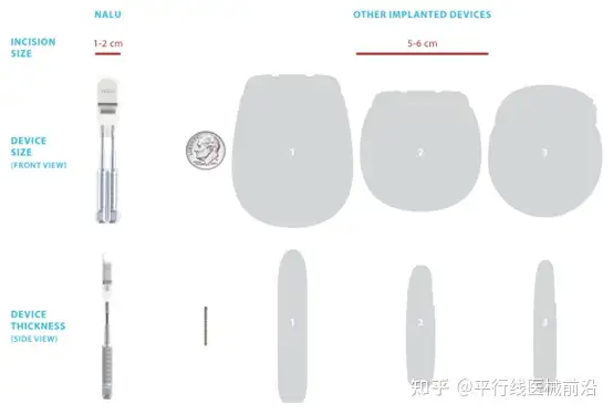 有谁了解微创神经调控术？ - 平行线医械前沿的回答- 知乎