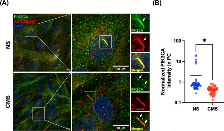 I 類磷脂酰肌醇3-激酶（PI3Ks）激活小梁網(wǎng)細(xì)胞中拉伸誘導(dǎo)的自噬