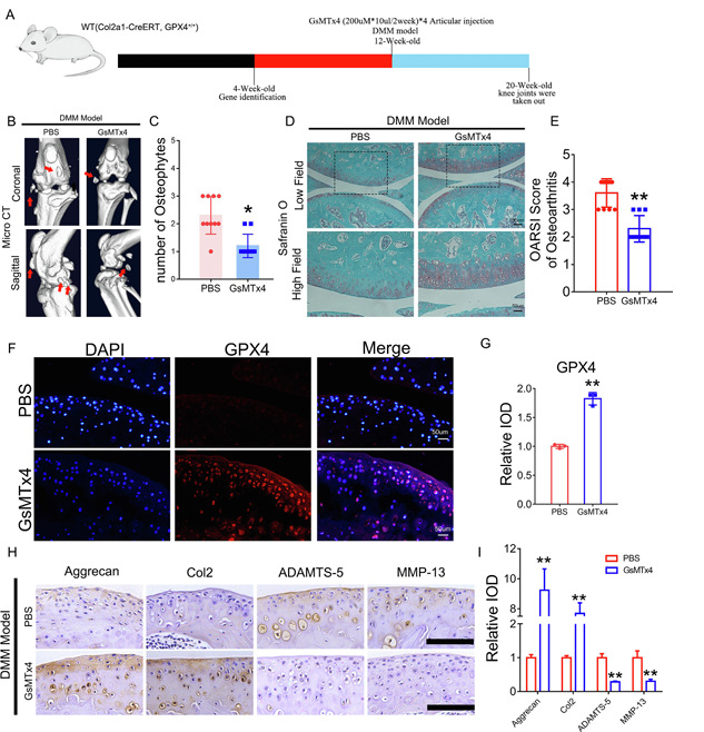 機械超負荷通過 Piezo1 通道促進鈣內流誘導骨關節炎中 GPX4 調節的軟骨細胞鐵死亡 機械超負荷通過 Piezo1 通道促進鈣內流誘導骨關節炎中 GPX4 調節的軟骨細胞鐵死亡
