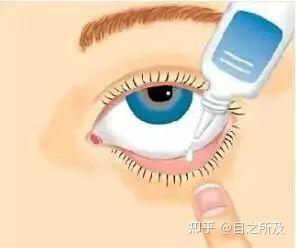 01%硫酸阿托品滴眼液会使瞳孔散大和畏光吗? 