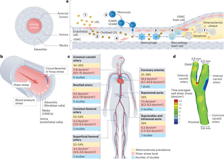 動脈粥樣硬化中血流誘導的內皮細胞重編程 動脈粥樣硬化中血流誘導的內皮細胞重編程