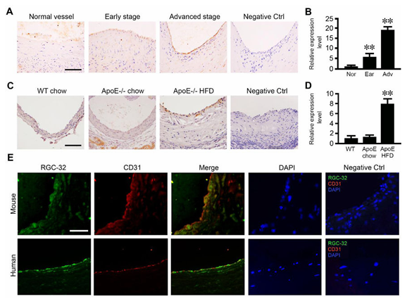 RGC-32 缺失可保护内皮细胞免受炎症损伤并减轻动脉粥样硬化 RGC-32 缺失可保护内皮细胞免受炎症损伤并减轻动脉粥样硬化