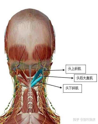 颈椎生理曲度变直,引起的头痛,如何根治? 