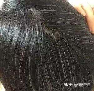 白头发怎么变黑发 _白头发如何变黑