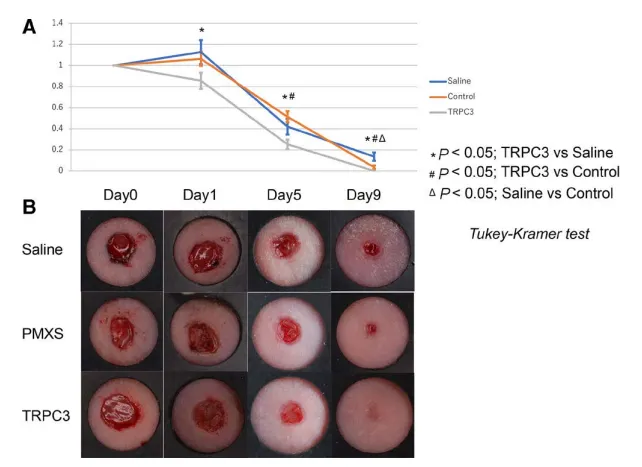 拉伸通過增強成纖維細胞中內皮素受體B和TRPC3 的表達來促進傷口收縮