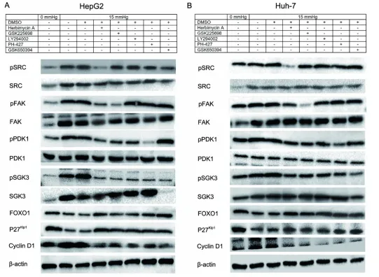壓力響應(yīng)型 miRNA - 5703 的過(guò)表達(dá)抑制壓力誘導(dǎo)的肝癌生長(zhǎng)和轉(zhuǎn)移