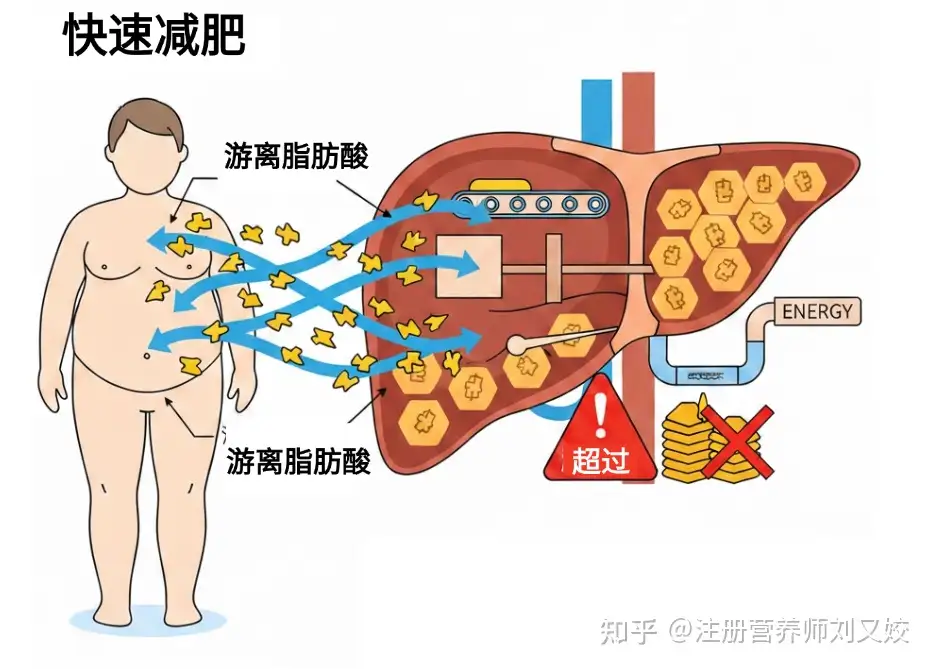 女子断碳水、高强度运动两月，暴瘦 30 斤后被确诊糖尿病前期，为什么会这样？其中有哪些减肥误区要警惕？