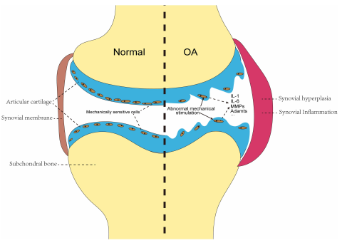 機械信號轉導:流體剪切力在骨關節炎發展中的關鍵作用 機械信號轉導:流體剪切力在骨關節炎發展中的關鍵作用