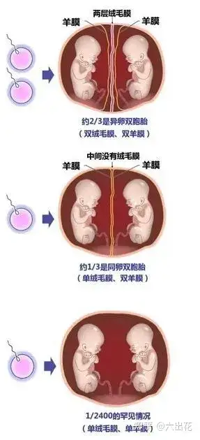孕晚期双胞胎一般都是什么时候会发动? - 知乎