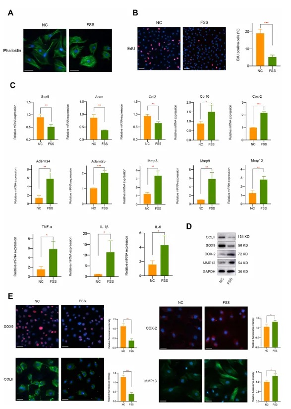 異常流體剪切應力通過 H3K4me3 對 ZBTB20 的表觀遺傳調控促進關節軟骨發病機制