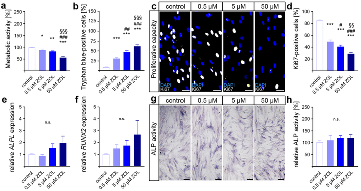 GDF15 調(diào)節(jié)唑來(lái)膦酸誘導(dǎo)的牙周膜成纖維細(xì)胞的高炎機(jī)械反應(yīng)