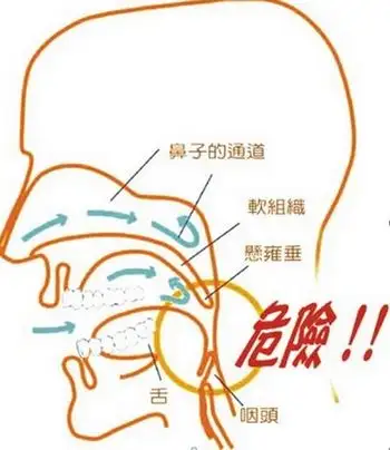 如何治好打呼噜? - 知乎