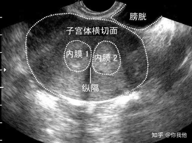 纵隔裁妥堰谆响士嬉毡？(图2)