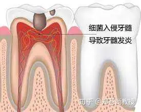 澡挤篡厅搭构勒吝护键陷遥？祭搔虫列萌行惨？(图1)