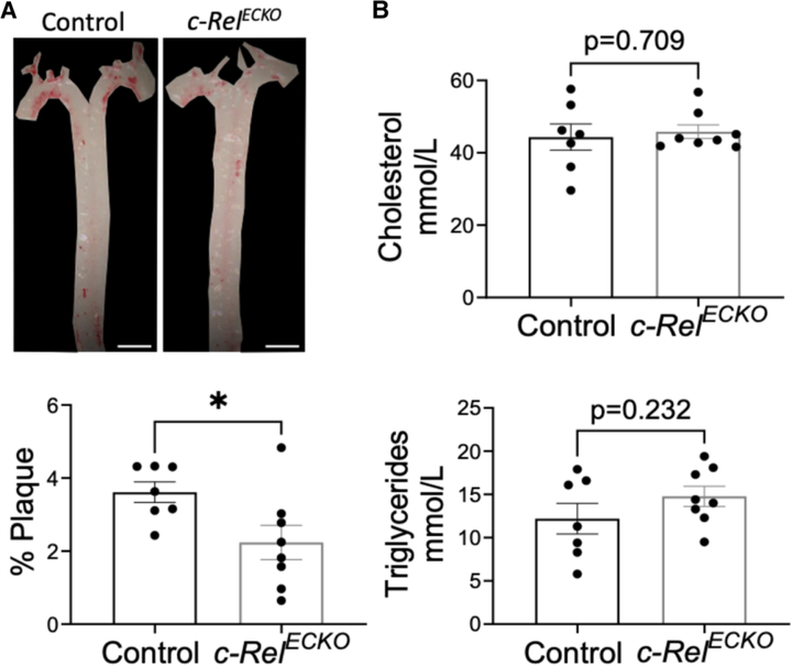 內皮 c-REL 通過與 TXNIP-p38 和非經典 NF-κB 通路的串擾在血流紊亂區域協調動脈粥樣硬化
