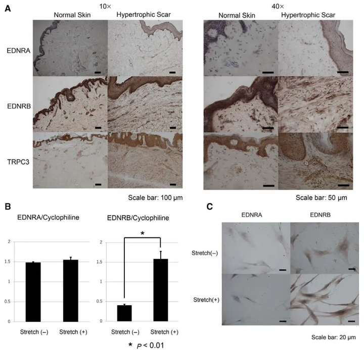 拉伸通過增強成纖維細胞中內皮素受體B和TRPC3 的表達來促進傷口收縮