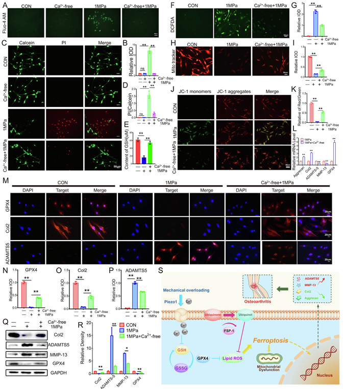 機械超負荷通過 Piezo1 通道促進鈣內流誘導骨關節炎中 GPX4 調節的軟骨細胞鐵死亡 機械超負荷通過 Piezo1 通道促進鈣內流誘導骨關節炎中 GPX4 調節的軟骨細胞鐵死亡