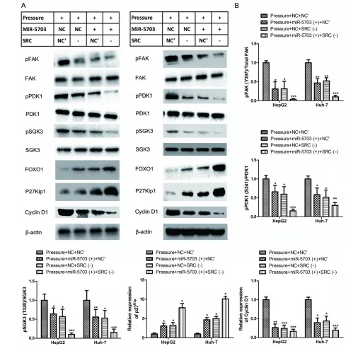 壓力響應(yīng)型 miRNA - 5703 的過(guò)表達(dá)抑制壓力誘導(dǎo)的肝癌生長(zhǎng)和轉(zhuǎn)移