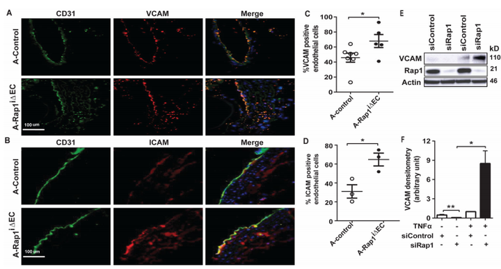 內皮細胞中的 Rap1 可限制炎癥信號傳導,從而抑制動脈粥樣硬化的進展 內皮細胞中的 Rap1 可限制炎癥信號傳導,從而抑制動脈粥樣硬化的進展