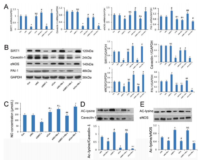 人参皂苷 Rb1通过调控 SIRT1/caveolin-1/eNOS 信号通路来预防年龄相关的血管内皮细胞衰老 人参皂苷 Rb1通过调控 SIRT1/caveolin-1/eNOS 信号通路来预防年龄相关的血管内皮细胞衰老