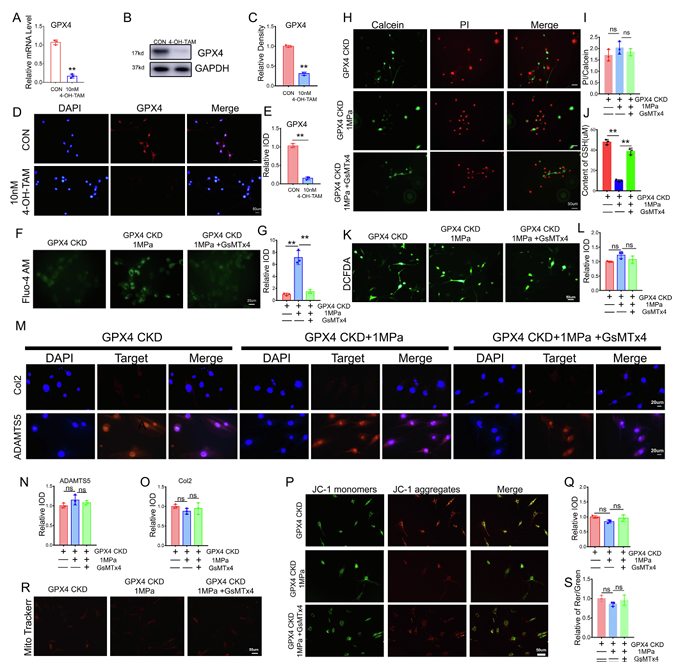 機械超負荷通過 Piezo1 通道促進鈣內流誘導骨關節炎中 GPX4 調節的軟骨細胞鐵死亡 機械超負荷通過 Piezo1 通道促進鈣內流誘導骨關節炎中 GPX4 調節的軟骨細胞鐵死亡