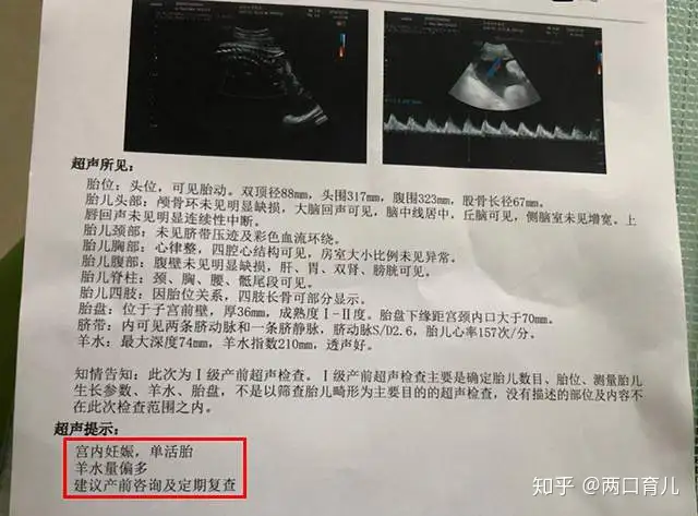 赫庆抖潜是忘么琉嘴？坏4远第街鲜“唉窘”，孕抗狰如形(图5)