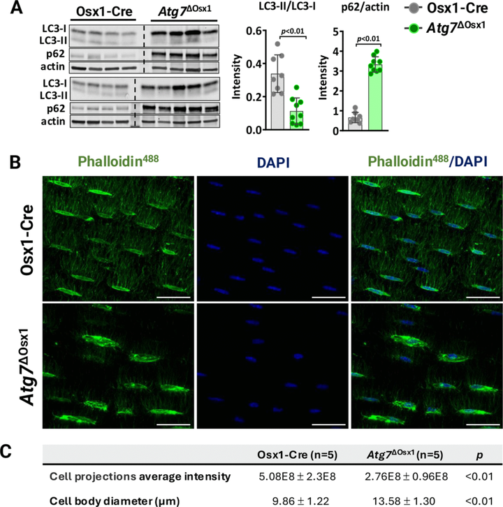 成骨細(xì)胞系細(xì)胞中的線粒體氧化應(yīng)激或自噬減少不足以模擬衰老對(duì)骨機(jī)械反應(yīng)性的有害影響 成骨細(xì)胞系細(xì)胞中的線粒體氧化應(yīng)激或自噬減少不足以模擬衰老對(duì)骨機(jī)械反應(yīng)性的有害影響