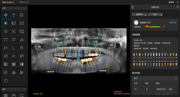 引领口腔行业数字化升级,睿知影口腔智能影像服务,重磅上线