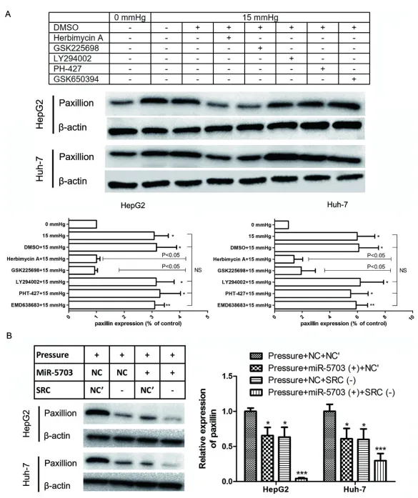 壓力響應(yīng)型 miRNA - 5703 的過(guò)表達(dá)抑制壓力誘導(dǎo)的肝癌生長(zhǎng)和轉(zhuǎn)移