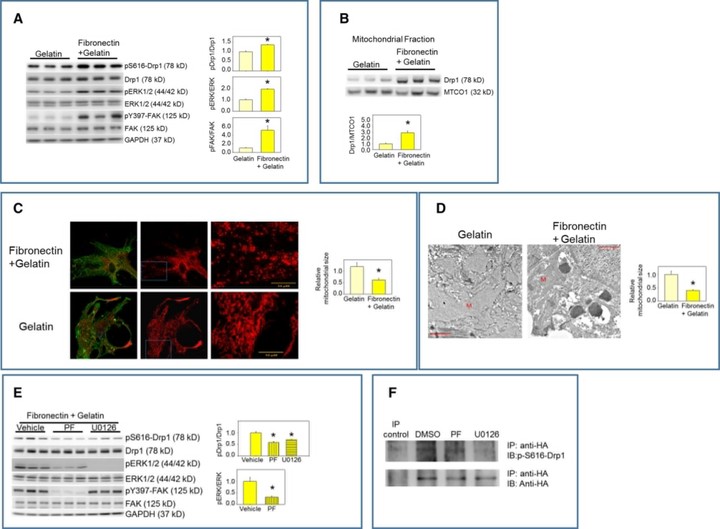 粘着斑激酶（FAK）通过动力蛋白相关蛋白1（Drp1）调控心肌细胞线粒体裂变和功能