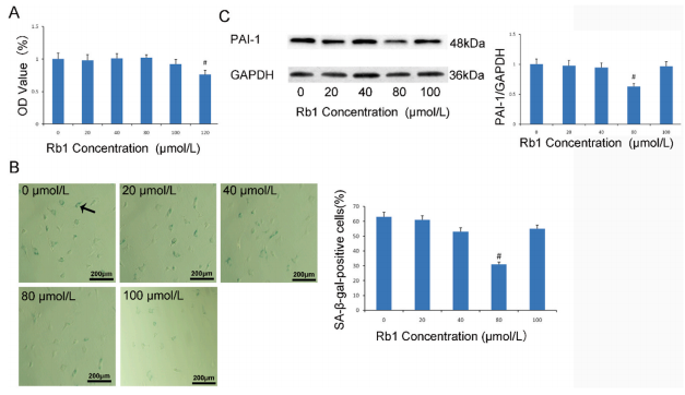 人参皂苷 Rb1通过调控 SIRT1/caveolin-1/eNOS 信号通路来预防年龄相关的血管内皮细胞衰老 人参皂苷 Rb1通过调控 SIRT1/caveolin-1/eNOS 信号通路来预防年龄相关的血管内皮细胞衰老