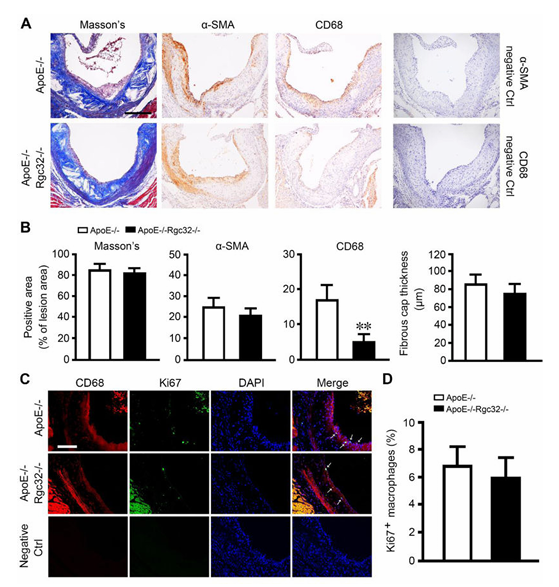 RGC-32 缺失可保护内皮细胞免受炎症损伤并减轻动脉粥样硬化 RGC-32 缺失可保护内皮细胞免受炎症损伤并减轻动脉粥样硬化