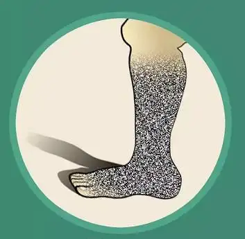 蹲厕所蹲到脚麻是什么感受