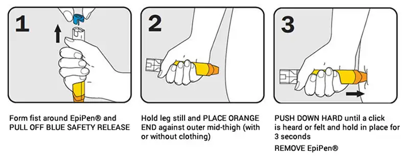 请解释一下肾上腺素到底有多牛？
