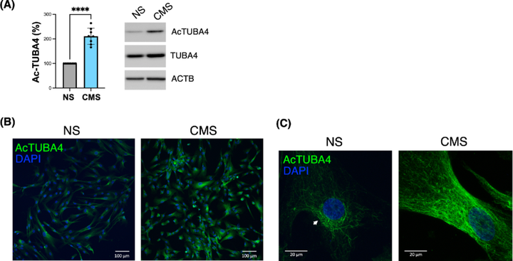 微管蛋白乙酰化增強機械應力下小梁網細胞的微管穩定性