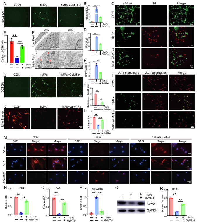 機械超負荷通過 Piezo1 通道促進鈣內流誘導骨關節炎中 GPX4 調節的軟骨細胞鐵死亡 機械超負荷通過 Piezo1 通道促進鈣內流誘導骨關節炎中 GPX4 調節的軟骨細胞鐵死亡