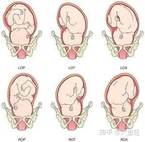 loa 胎儿头在哪里啊?